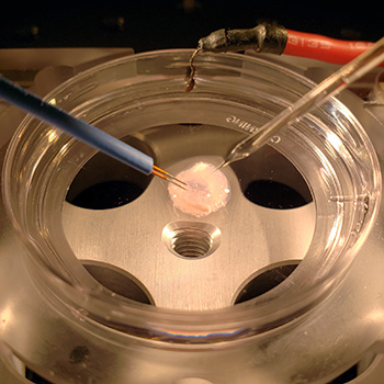 Bioengineered brain in a petri dish